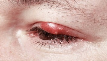 Nikdy nechoďte spať bez odlíčenia. Odborníčka varuje pred následkami na zdraví