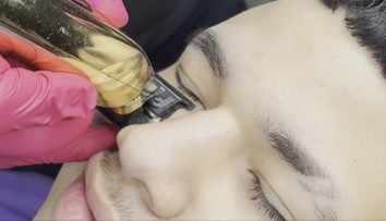 Čoraz viac mužov si skracuje mihalnice. Doktorka vysvetľuje, prečo to je nebezpečné