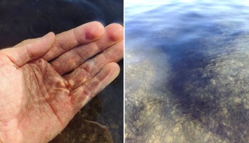 Vyšli ste z vody bodkovaní? Čierne zrnká zaplavili bratislavské jazerá