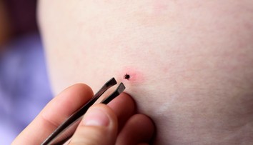 Robíte to takto? Odborníčka vysvetlila, ako správne vyberať kliešte