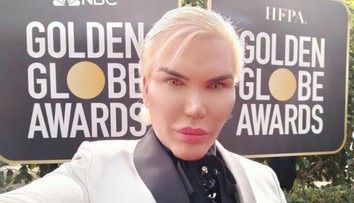 Vrchol nechutnosti: Ľudskému Kenovi (34) odstránili štyri rebrá, odfotil si ich a ukázal