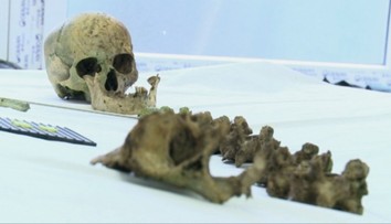Telá vykopával aj na Slovensku. U muža z Maďarska našli lebky či časti končatín, ktoré jedol