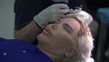 Najznámejší Ken všetkých šokoval: Po plastikách prišla najradikálnejšia premena