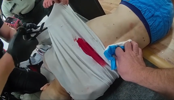 VIDEO: Na ubytovni v Žiline mala žena bodnúť muža a kopať ho do hlavy. Pozrite si, ako mu polícia zachraňovala život