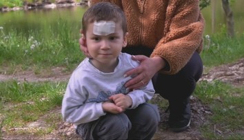 Adamko (3) sa rozbehol za kačicami, o pár sekúnd tiekla krv. Pokojné popoludnie v Tlmačoch sa zmenilo na chvíle hrôzy