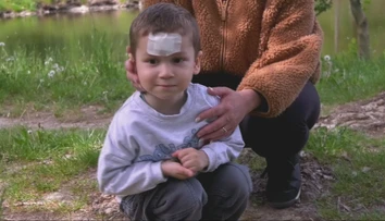 Adamko (3) sa rozbehol za kačicami, o pár sekúnd tiekla krv. Pokojné popoludnie v Tlmačoch sa zmenilo na chvíle hrôzy