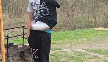 Nerovný súboj pred školou. Do strkanice medzi deťmi sa mal zapojiť rodič, chlapec skončil so zlomenou rukou