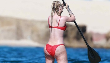 Toľko celulitídy ste pokope asi nevideli. Tomuto zadku nepomohla ani plastika