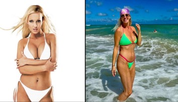 Operácia ju desila, no s výsledkom je spokojná. Moderátorka prezradila, prečo si nechala vybrať implantáty