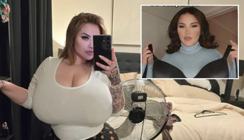 Austrálčanka trpí vzácnou poruchou. Prsia jej začali nekontrolovateľne rásť, keď mala 25 rokov