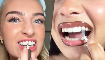 Biely úsmev za sekundu? Dentálna hygienička vysvetľuje, čo sa skrýva za virálnym lakom na zuby