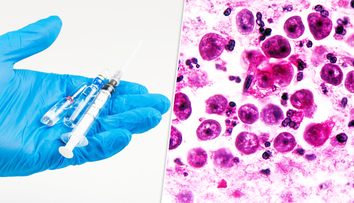 Liek proti smrteľnej amébe, ktorá desí Slovákov? Českí vedci majú sľubnú odpoveď, chýba im však jedna vec