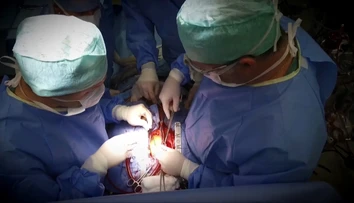Vo Viedni vykonali prvú transplantáciu pľúc pacientovi s koronavírusom