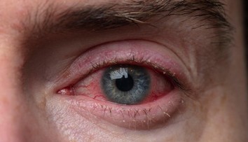 V Číne sa šíri vírus, ktorý napáda zrak. Vedci hovoria o nebezpečnom precedense