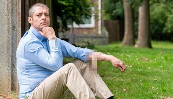 Pre chorobu prišiel o penis. Náhradný mu "vypestovali" na jeho ruke