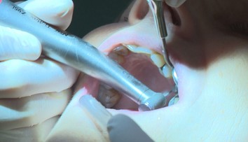 Pre zubárkin podvod jej poisťovňa nepreplatila korunku. Pani Oľga tak prišla o 100 eur