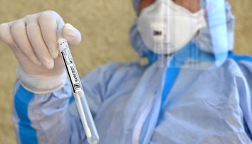 Štátne hmotné rezervy nakúpia pol milióna skríningových testov na COVID-19