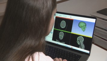 Mladá vedkyňa zo Slovenska mení pohľad na starnutie: Takto chce bojovať s Alzheimerom