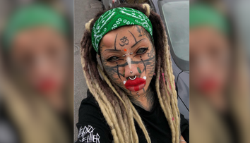 FOTO: Svojím vzhľadom poburuje ľudí. „Ľudská mačka“ s úpravami ani zďaleka nekončí