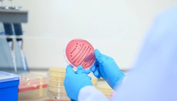 Nebezpečná kvasinka zabíja až 60 % infikovaných. Prvé prípady potvrdili už aj u našich susedov