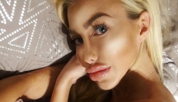 Nechutná poľská Barbie: Nohy ako palice, vysekaná sánka a pery cez pol tváre