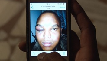 Kotlebov poslanec má problém. Takto mal dobiť muža tmavej pleti