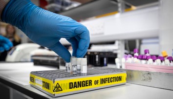 Vedci objavili gén, ktorý chráni pred ťažkým priebehom covidu. Zdedili sme ho po neandertálcoch