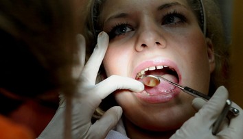 Zubári nesmú od júla používať amalgámové plomby pri týchto pacientoch