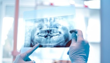 Muž prišiel pri zákroku na klinike v Turecku o všetky zuby. Príbeh sa skončil obrovskou tragédiou