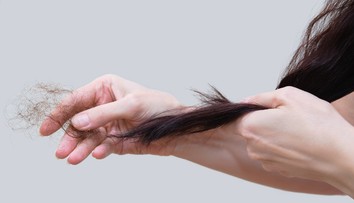 Niektorým ľuďom pre covid vypadávajú vlasy. Lekár radí, čo s tým robiť