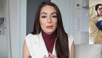 Popálená česká YouTuberka sa odhodlala: Ukázala fotku tesne po nehode