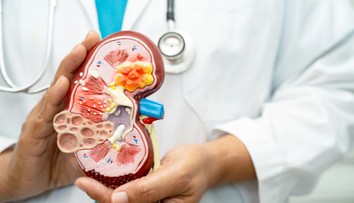 Zvláštny moč, opuchy, ale aj únava. Takto sa môžu hlásiť zlyhávajúce obličky, varujú lekári