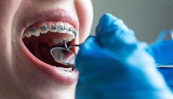 Prelomový krok českých vedcov: „Naprogramovali“ kmeňové bunky tak, aby tvorili zubné tkanivo