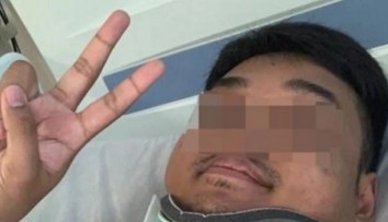 Neuveriteľný príbeh: Muž (24) po nehode zostal ležať na zemi, život mu zachránili moderné technológie