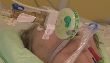 Koho zapojiť na pľúcnu ventiláciu a koho nie? Ministerstvo zverejnilo manuál pre lekárov