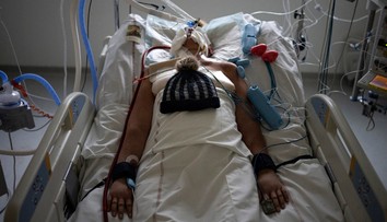 Nové príznaky covidu, ktoré spôsobuje najmä variant omikron. Sledujte si pery, pokožku aj nechty