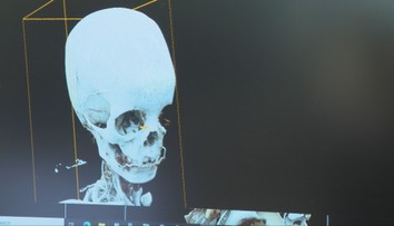 Ukázali technológie, ktoré majú zlepšiť slovenské zdravotníctvo. Niektoré vás prekvapia