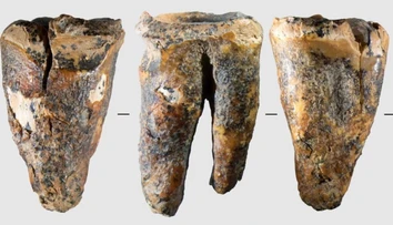 Vedci zostali po objave v šoku. Neandertálec si mal pred 59-tisíc rokmi „vyvŕtať“ pokazený zub