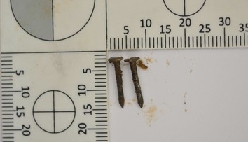 Policajti v Nových Zámkoch zadržali muža, ktorý na ulici rozhadzoval smrteľné návnady pre psov