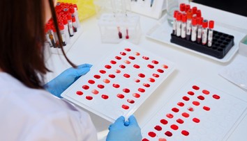 Vedci objavili novú krvnú skupinu. Zatiaľ je jej nositeľkou jediná žena na celom svete