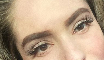 Česká YouTuberka, ktorá utrpela hrozivé popáleniny: Prvýkrát ukázala tvár