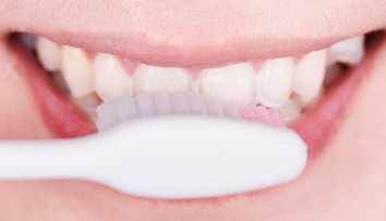 Robíte túto chybu po jedle? Zubár varuje, že si tak ničíte sklovinu