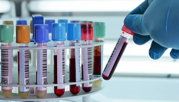 Pre spojenie laboratórií môže dôjsť v bratislavskej nemocnici ku kontaminácii krvi