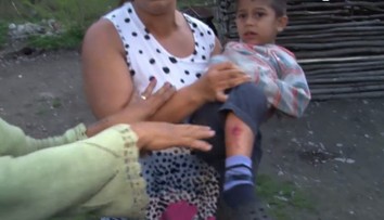 Premnožené psy v osade si vybrali svoju daň. Dohrýzli štvorročného chlapca