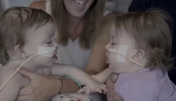 Lekári sa báli, že sa nemusia dožiť operácie. Teraz tieto siamské dvojičky úspešne oddelili