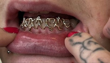 Netradičný, no dizajnový fenomén. Mladý remeselník Samuel vytvára šperky, ktoré patria na zuby