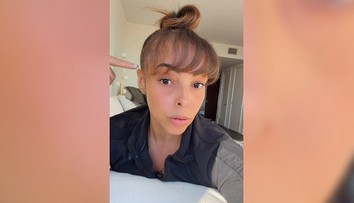 Vedľajší účinok šokoval aj lekára. Po transplantácii vlasov žena spozorovala nečakaný problém