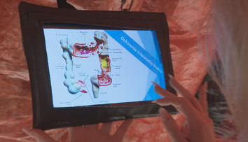 Týždenne na to zomiera 32 Slovákov. Vyšetrenie, ktoré im mohlo zachrániť život, mnohí odmietajú