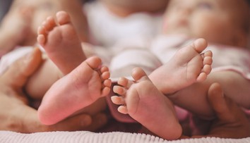 Veľký úspech lekárov. Podarilo sa im oddeliť len deväťmesačné siamské dvojičky, zrastené boli bruchom