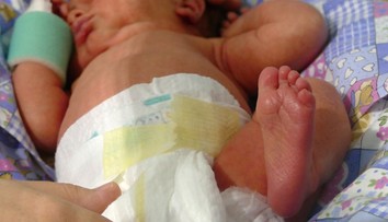 Unikátna operácia v Martine: Operovali tehotnú, ktorá mala vrastenú placentu do maternice